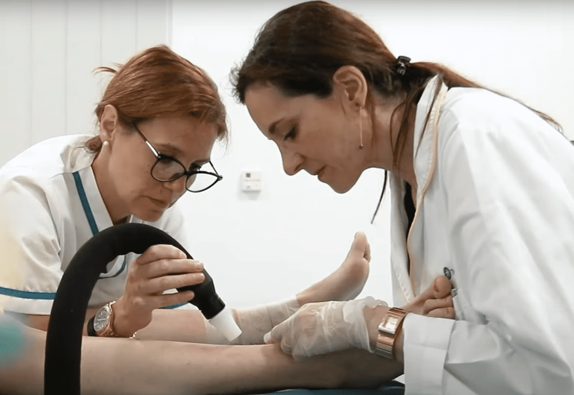 escleroterapia laser