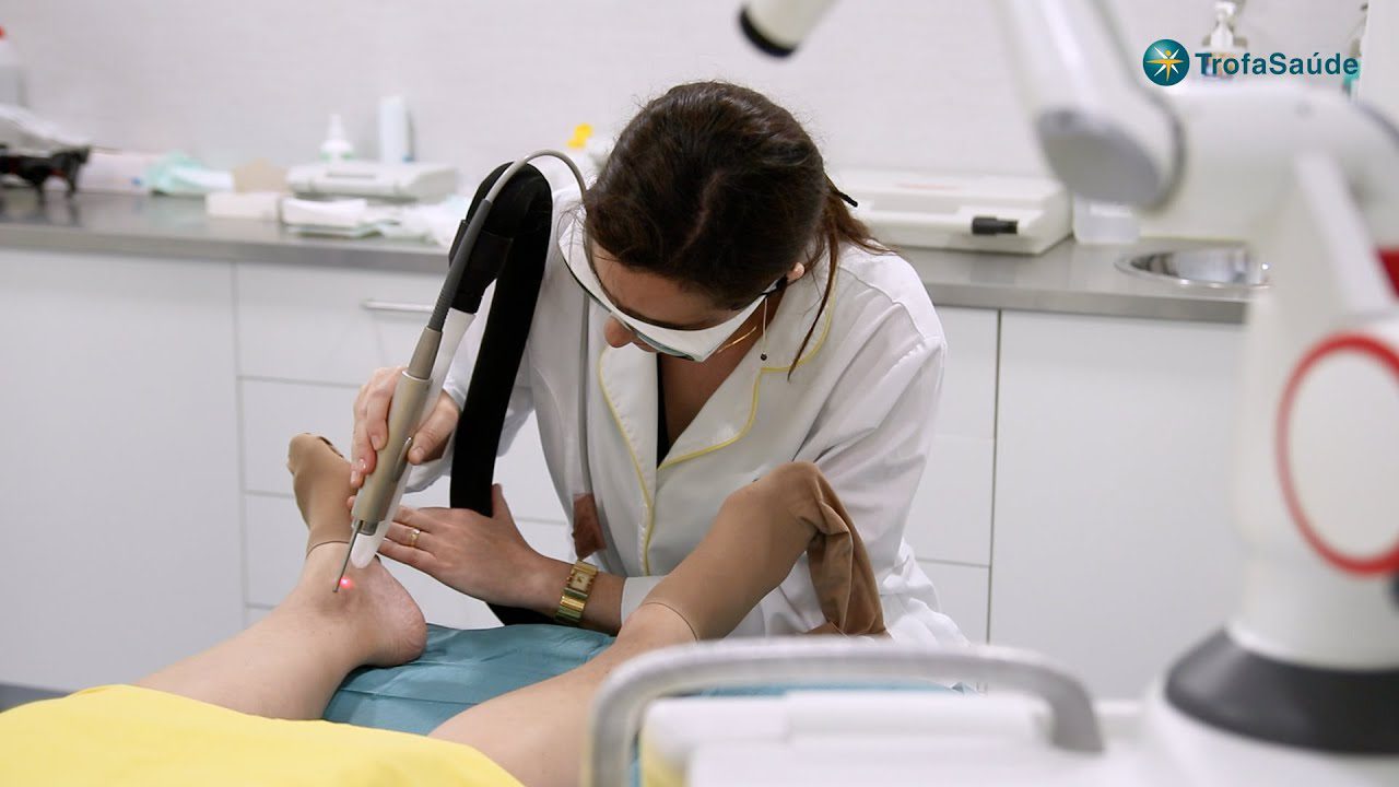 Utilização de laser transdérmico no tratamento de derrames vasculares