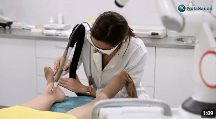 Novo tratamento de derrames vasculares